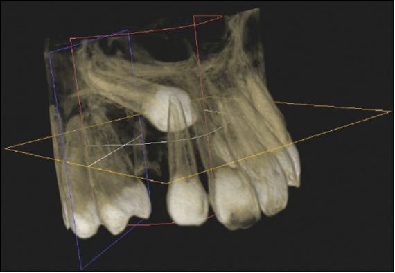 ortho exp